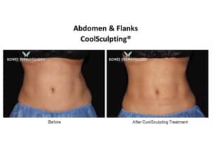 Abdomen Results #1